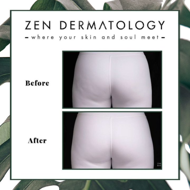 zen_dermatology_3