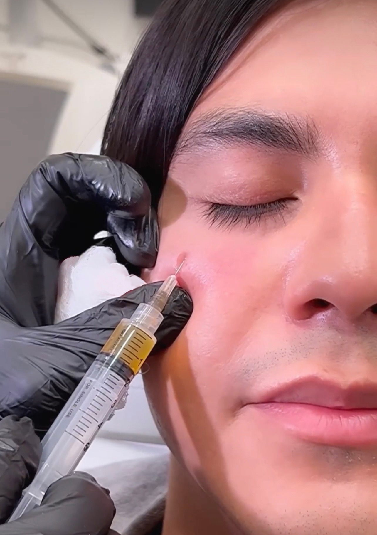 Woman with beautiful clean skin. Cosmetologist does injections by ZEN Dermatology in Sacramento, CA